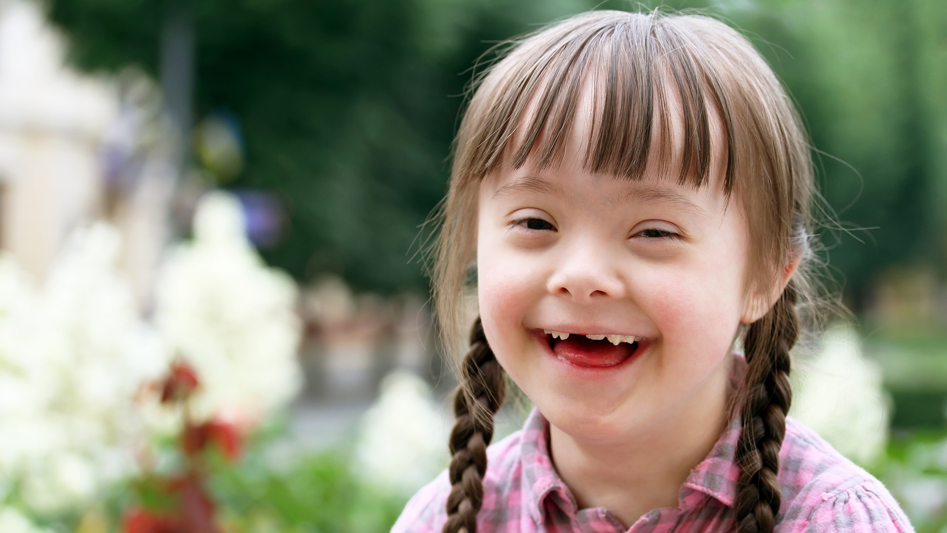 Managing Oral Habits in Children with Down Syndrome