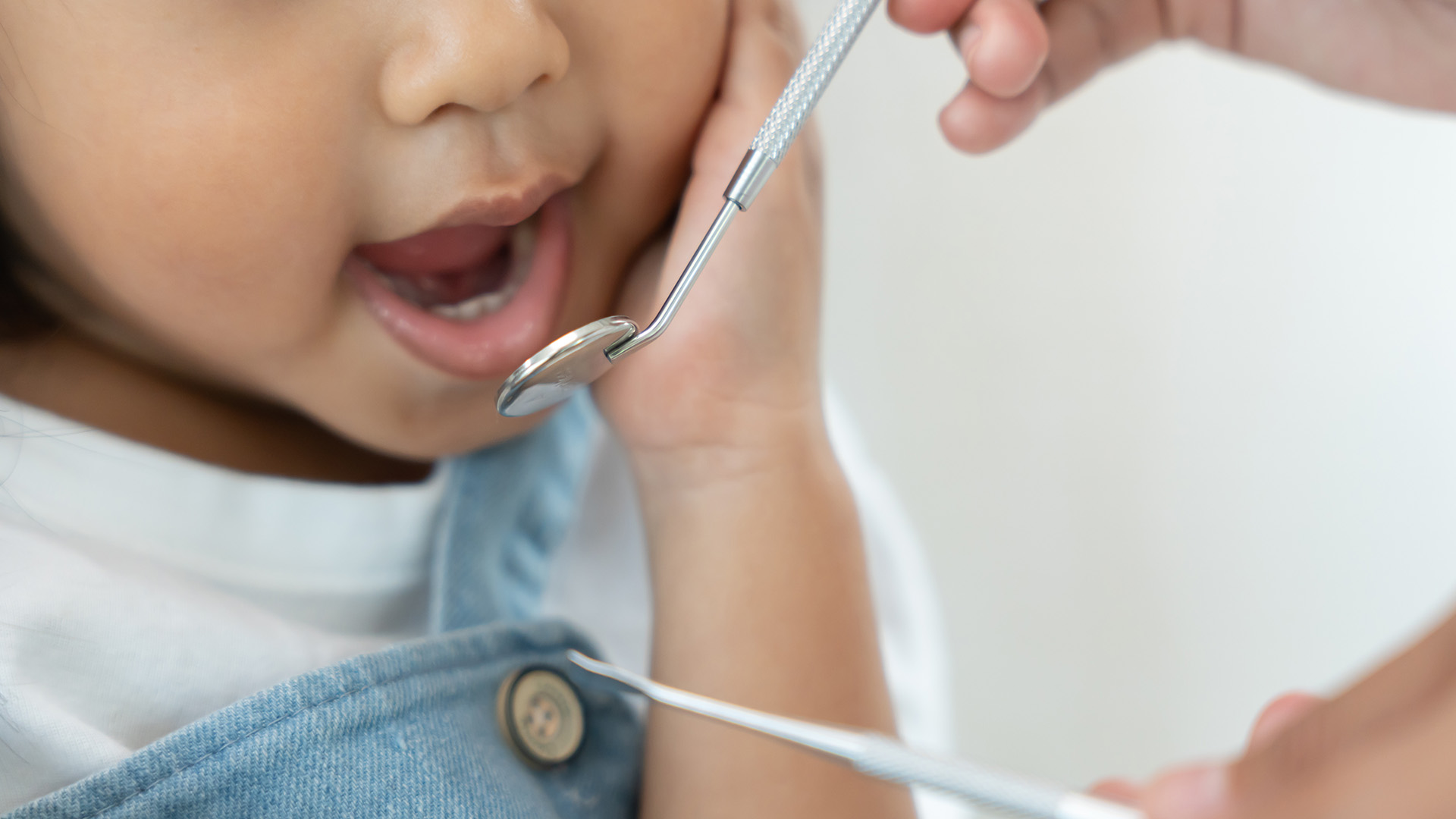 Fluoride Treatment for Kids, What Parents Should Know