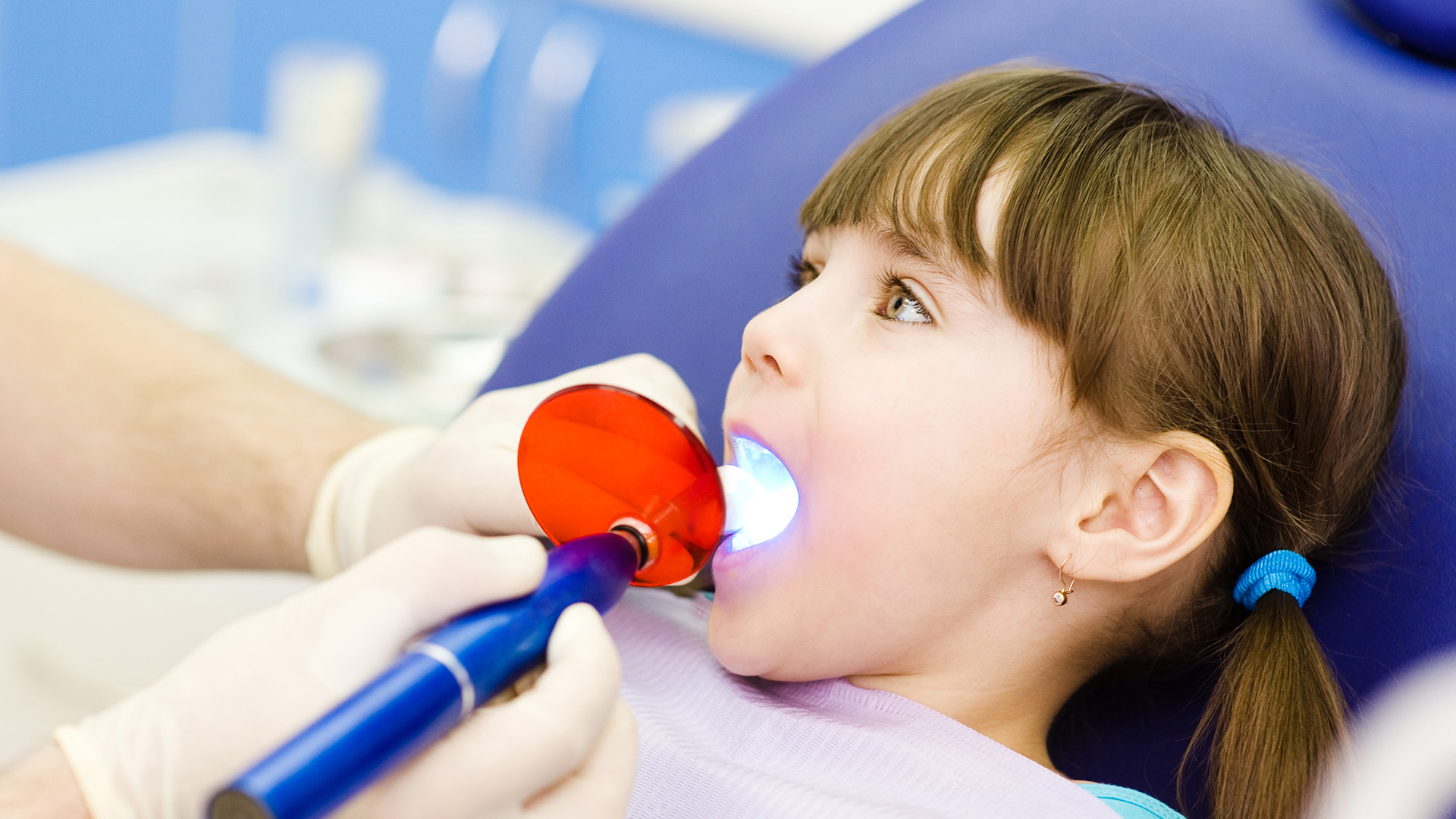 What Can My Child Eat After a Dental Filling